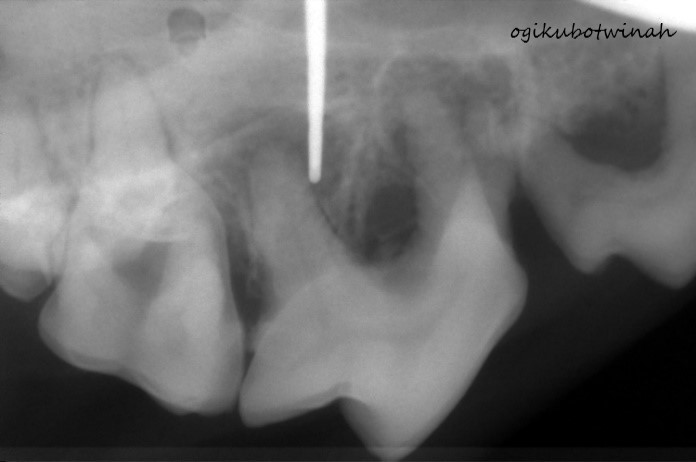歯科　レントゲン画像　歯周病の犬