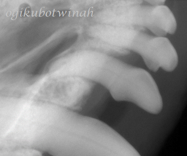 歯周組織再生療法　犬　歯周病　レントゲン