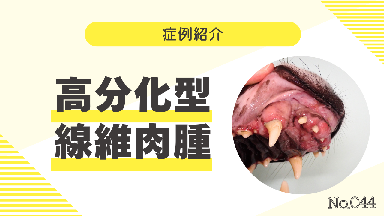 44_高分化型線維肉腫