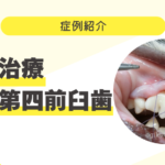 犬の奥歯の再生治療(上顎第四前臼歯) 60