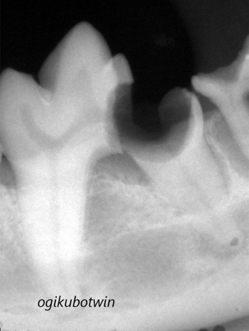 犬　虫歯　下顎第一後臼歯　レントゲン　C4