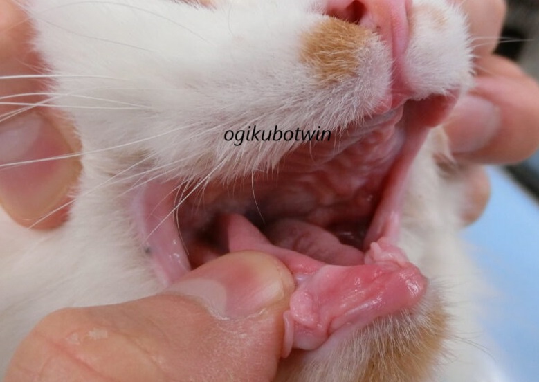 口内炎　治療後