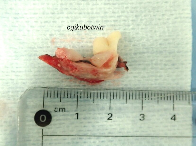 犬 周辺性歯原性線維腫 切除
