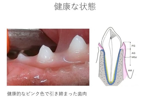 歯肉　健康な状態