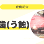 犬も虫歯になるの?【虫歯(う蝕)】 症例紹介サムネイル (5)