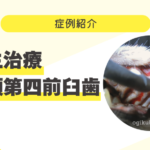 症例紹介サムネイル (6)