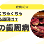 87_口をくちゃくちゃさせる原因は？犬の歯周病