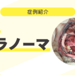 余命はどのくらい?犬のメラノーマ⑥ 92_犬のメラノーマ