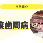 93_犬の軽度歯周病