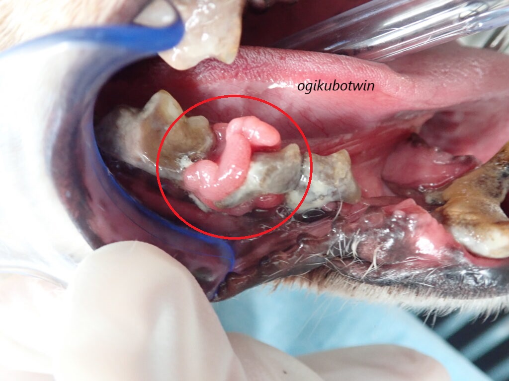 重度歯周病で全抜歯