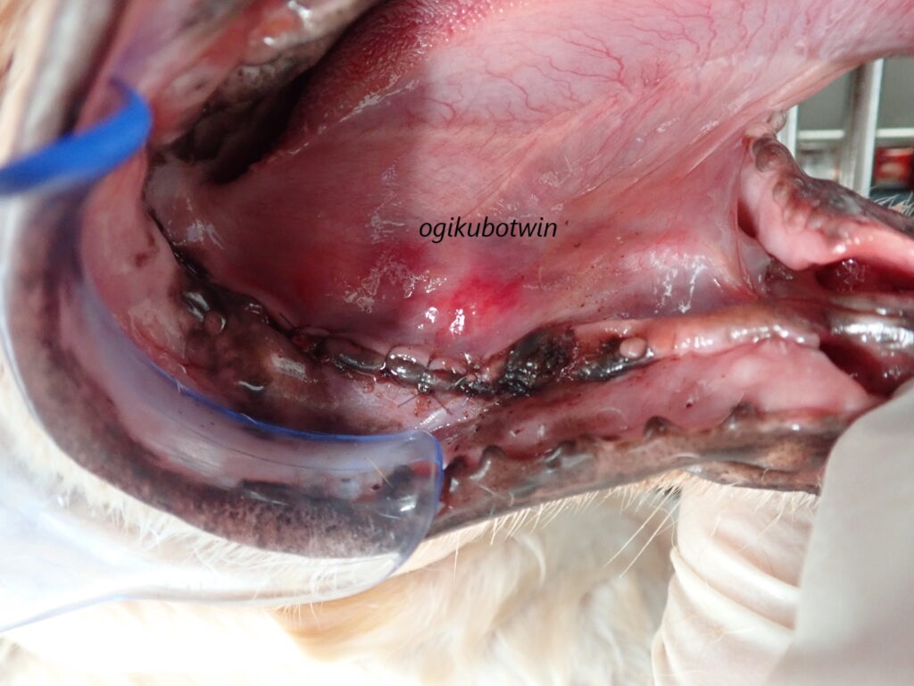 全抜歯 重度歯周病治療後