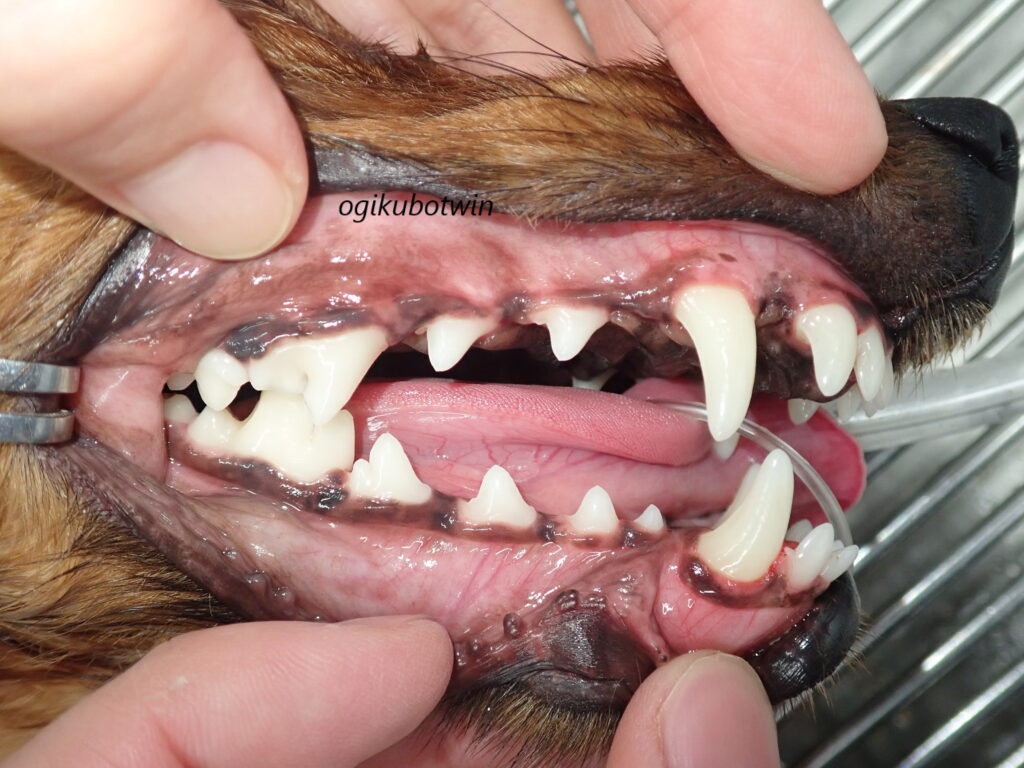 歯のクリーニング！軽度歯周病　治療後