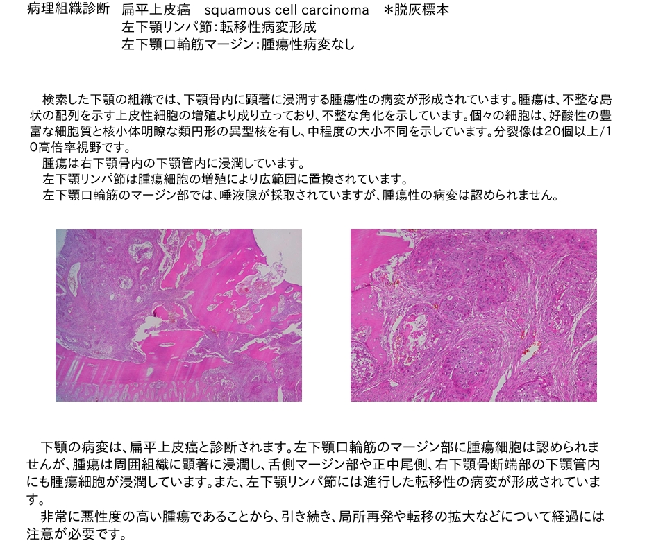 下顎骨切除!猫の扁平上皮癌 病理