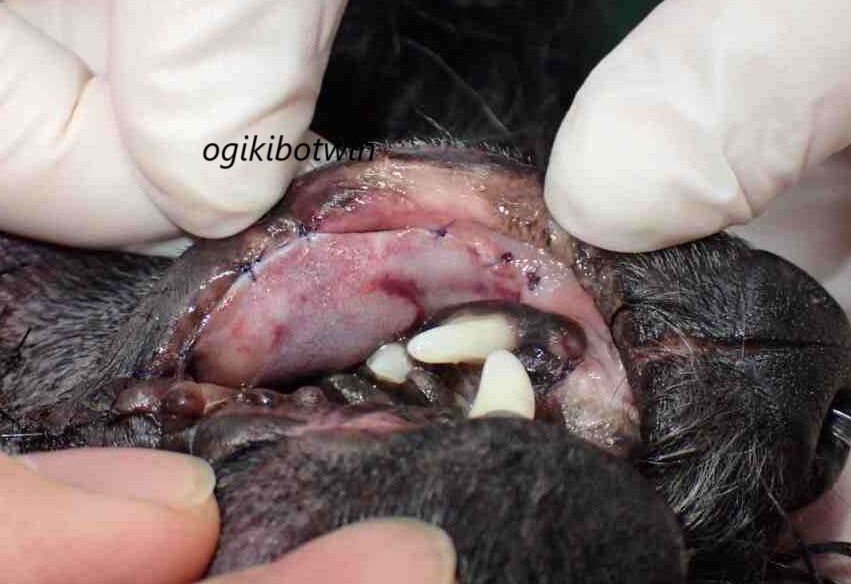 乏色素性メラノーマ(悪性黒色腫)