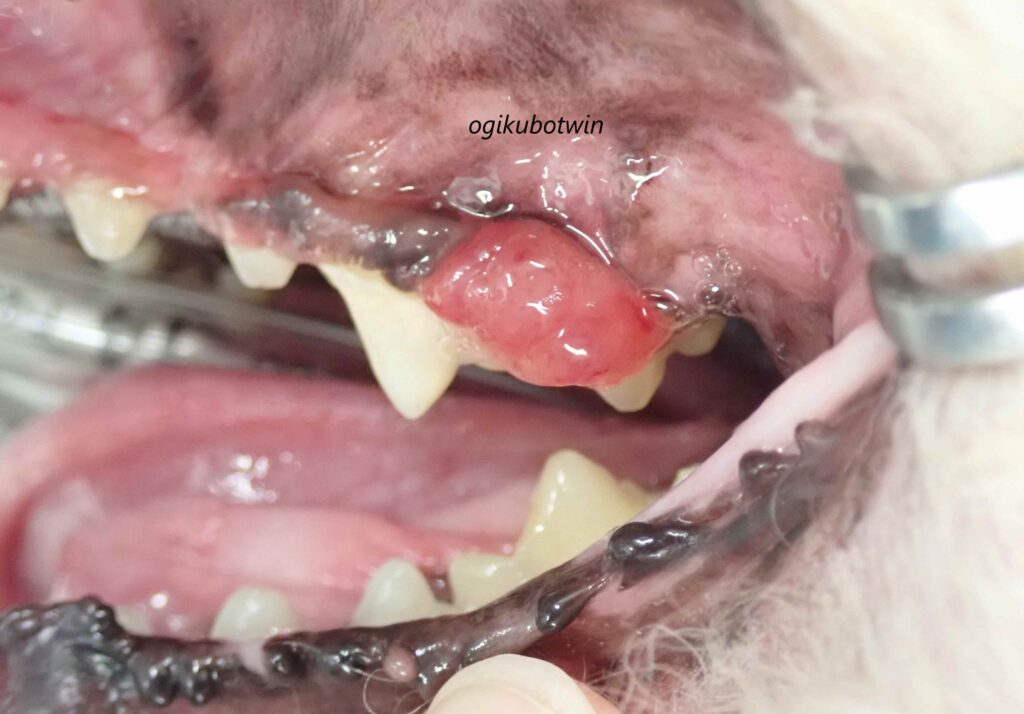 乏色素性メラノーマ(悪性黒色腫)