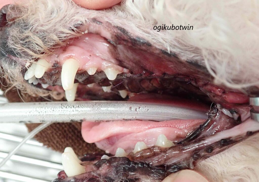 乏色素性メラノーマ(悪性黒色腫) 治療後