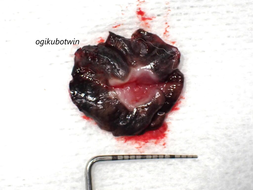 犬 口蓋リンパ腫 切除