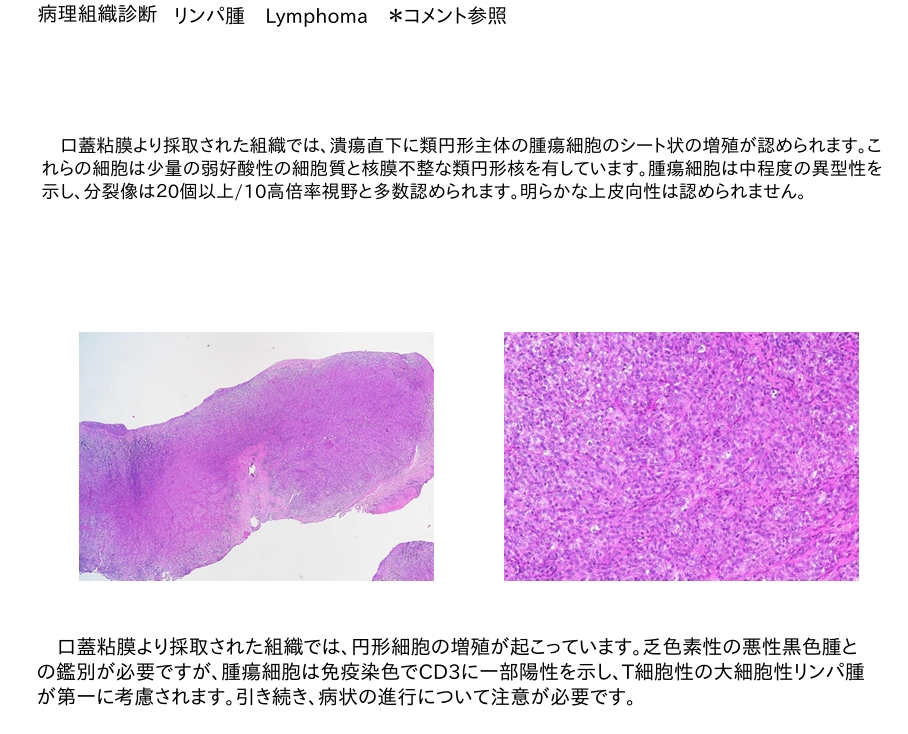 犬 口蓋リンパ腫 病理