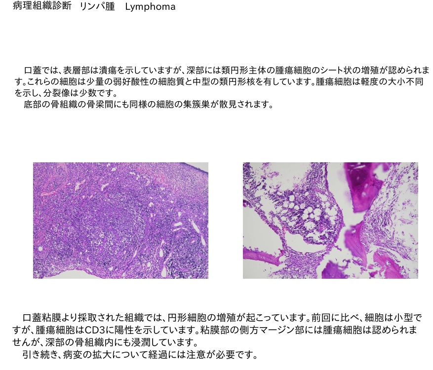 犬 口蓋リンパ腫 病理