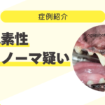 78_乏色素性メラノーマ疑い