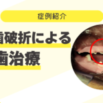 症例紹介サムネイル (10)