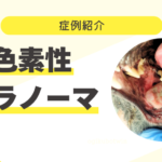 症例紹介サムネイル (8)