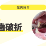 猫の犬歯破折 76_猫の犬歯破折