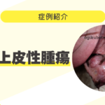 77_犬の悪性上皮性腫瘍