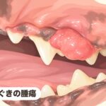 歯ぐきの腫瘍｜乏色素性メラノーマ（悪性黒色腫）疑い